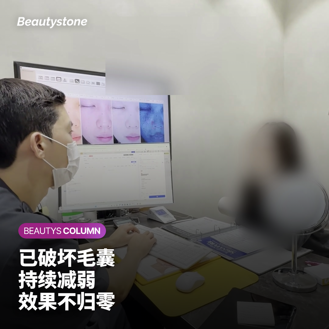显示已完成疗程与休止期毛囊再生关系的示意图