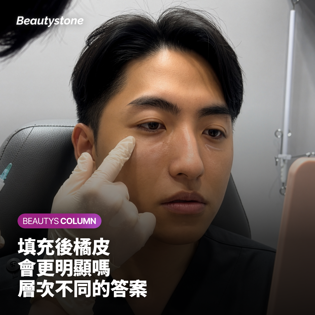 臀部填充後橘皮會不會變得更明顯