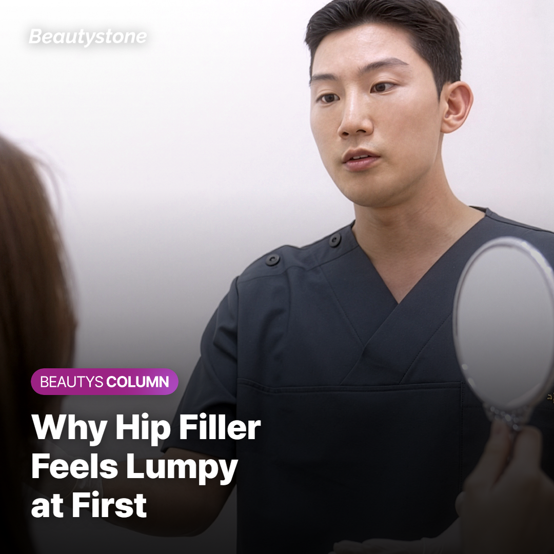 What Causes Lumps After Hip Filler?