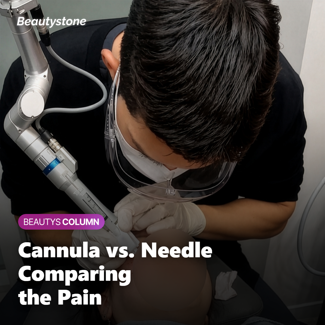 Diagram comparing pain from a cannula versus a needle