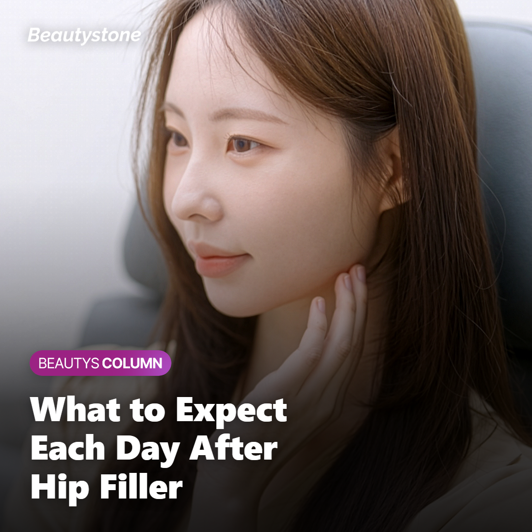 Day-by-Day Hip Filler Recovery Timeline