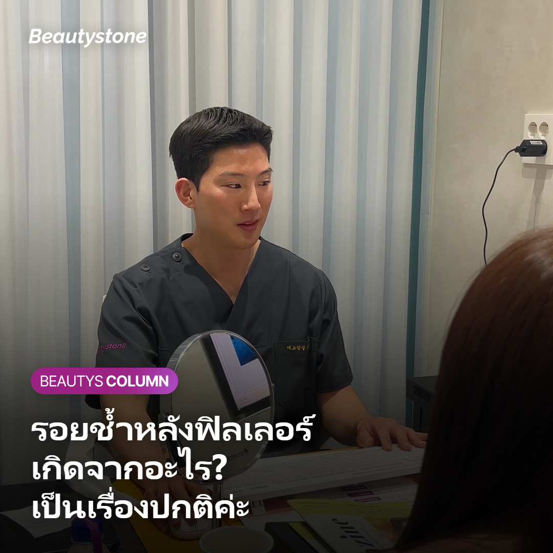 สาเหตุที่เกิดรอยช้ำและอาการบวมหลังฉีดฟิลเลอร์