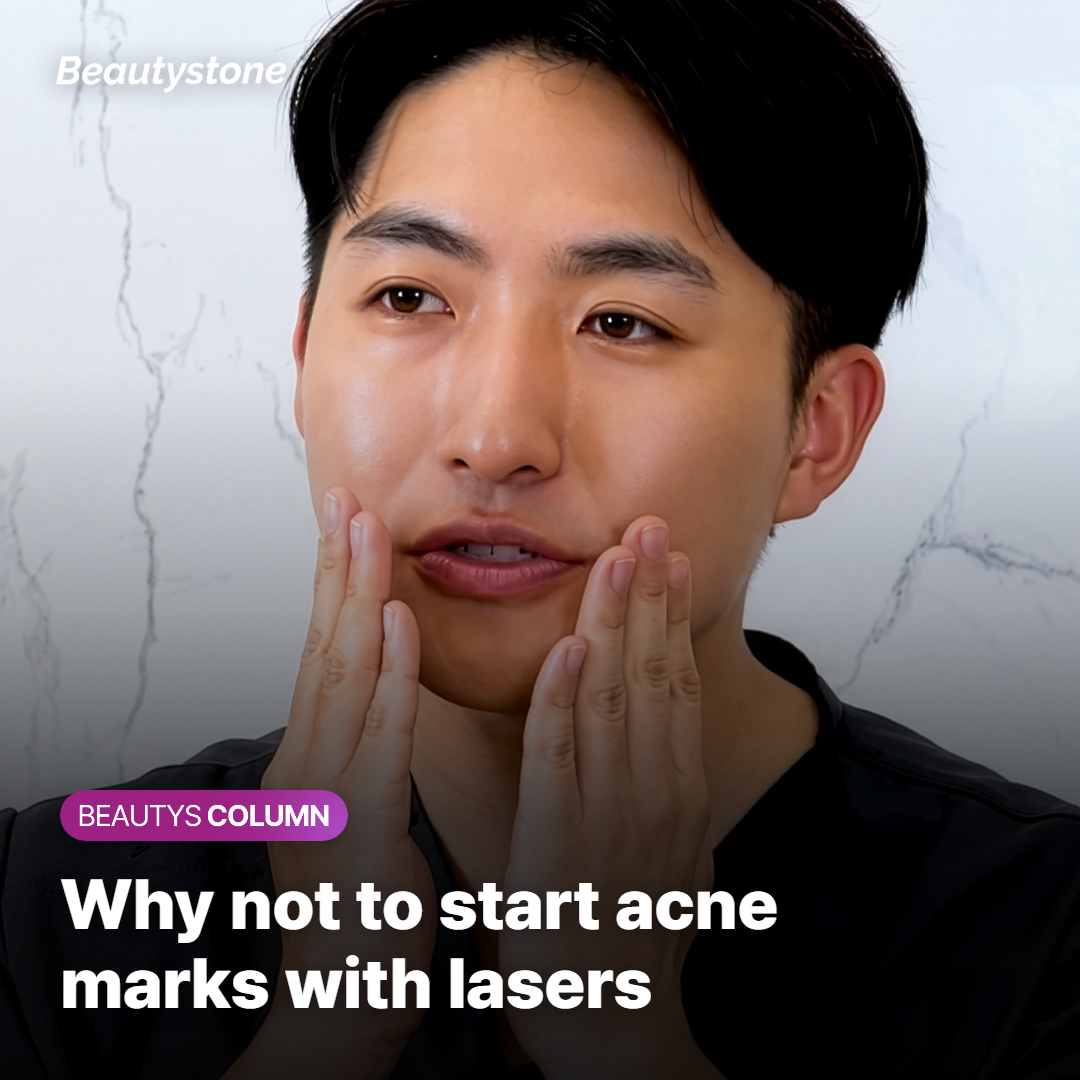 Dermatology clinic director explains how to remove acne marks