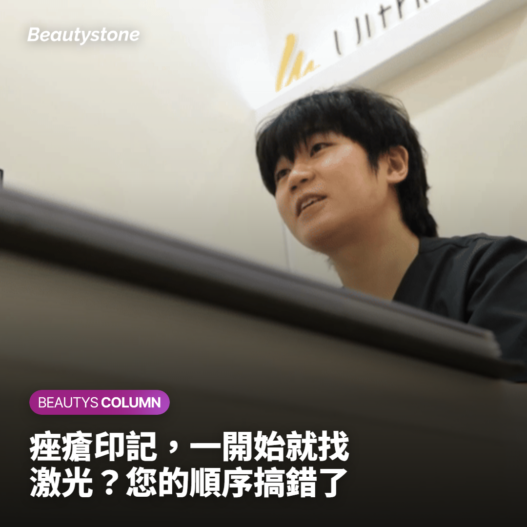 痤瘡印記消除方法 皮膚科院長說明