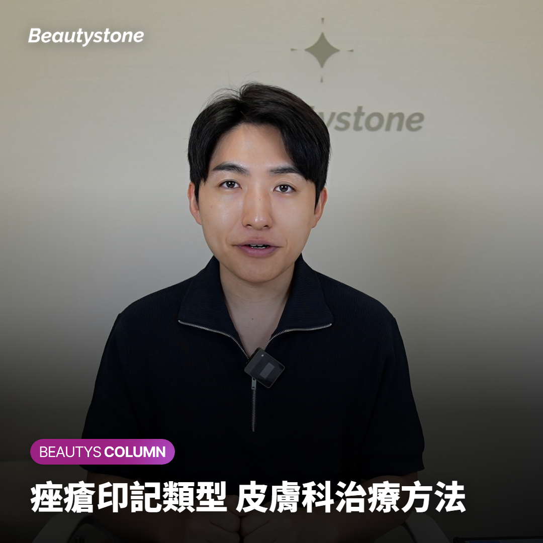 痤瘡印記類型 皮膚科治療方法
