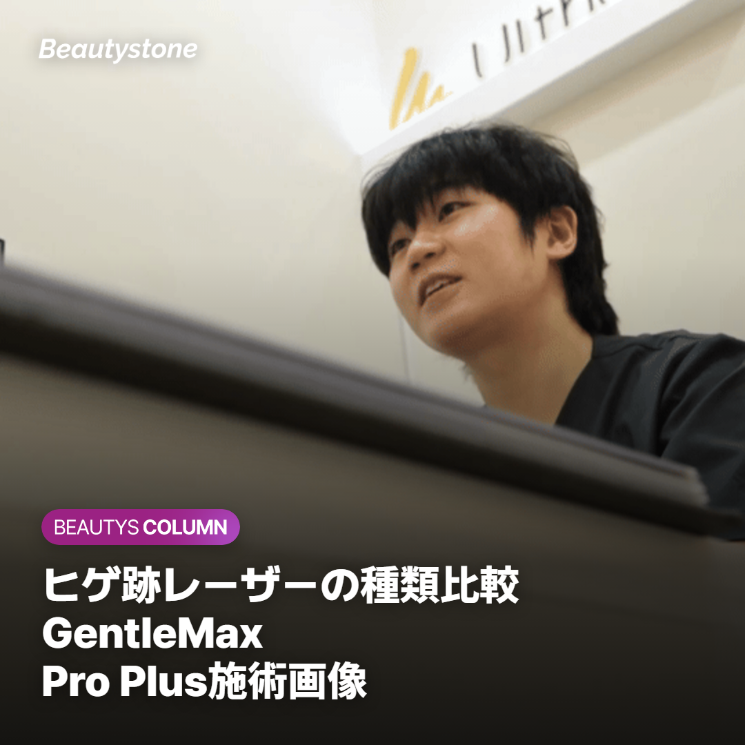 ヒゲ跡レーザーの種類比較 GentleMax Pro Plus施術画像