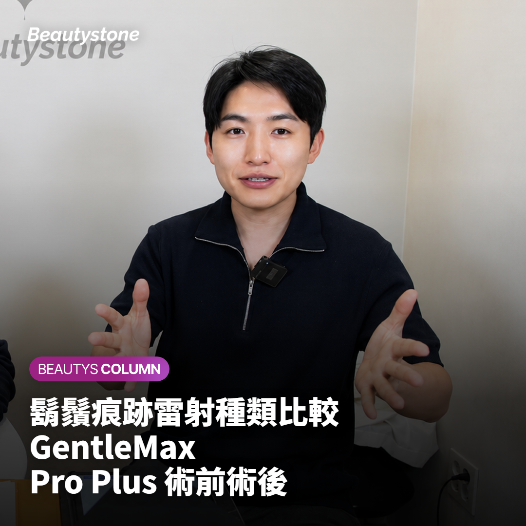 鬍鬚痕跡雷射種類比較 GentleMax Pro Plus 術前術後
