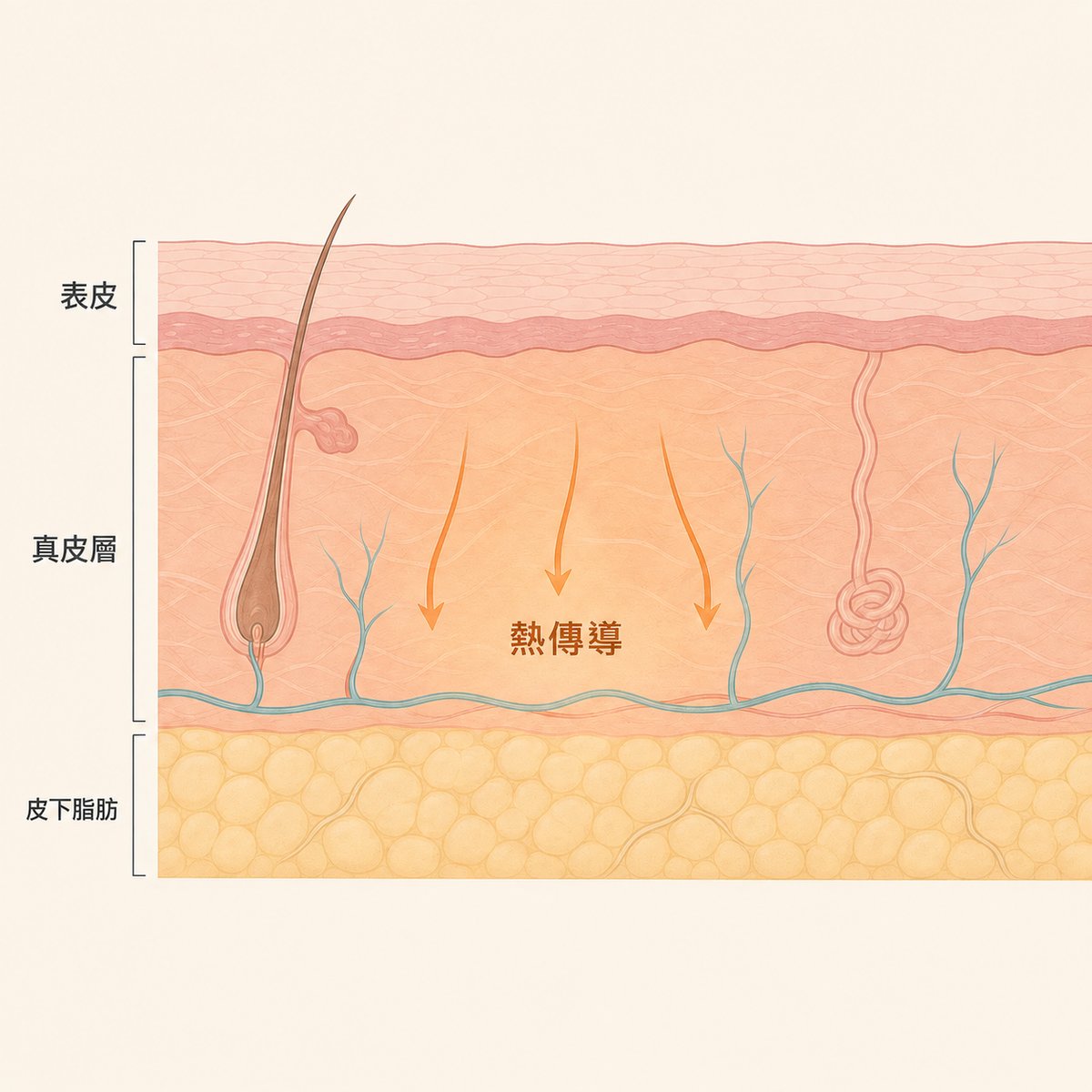射頻熱能傳導至真皮層的示意圖