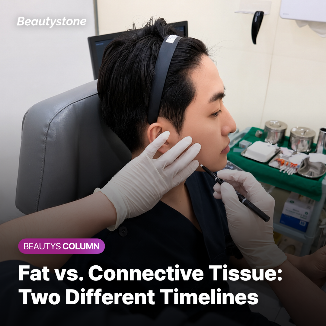 Diagram showing fat cells and fibrous septae in the jawline undergoing RF-driven thermal disruption with different response rates