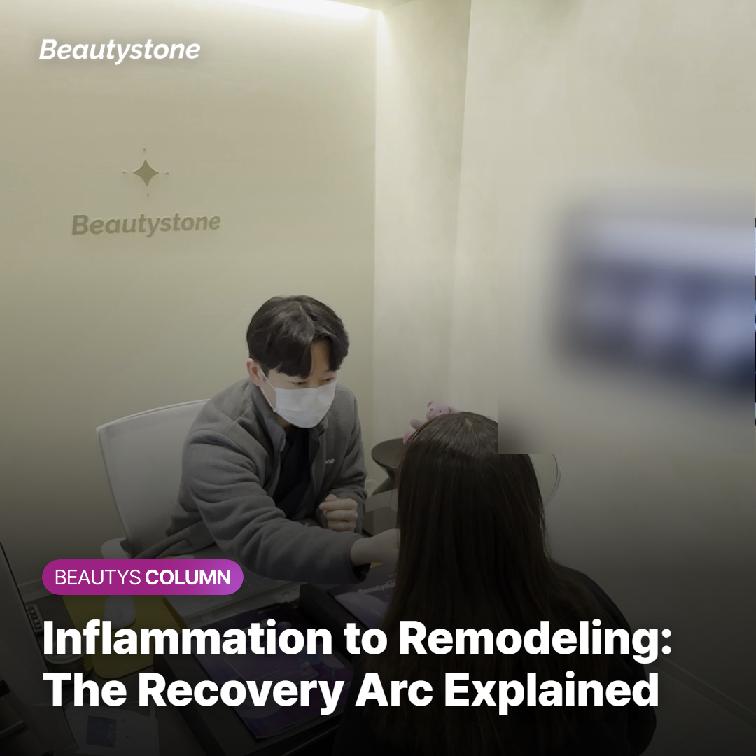 Timeline graphic of the jawline inflammatory and collagen remodeling phases after InMode FX treatment
