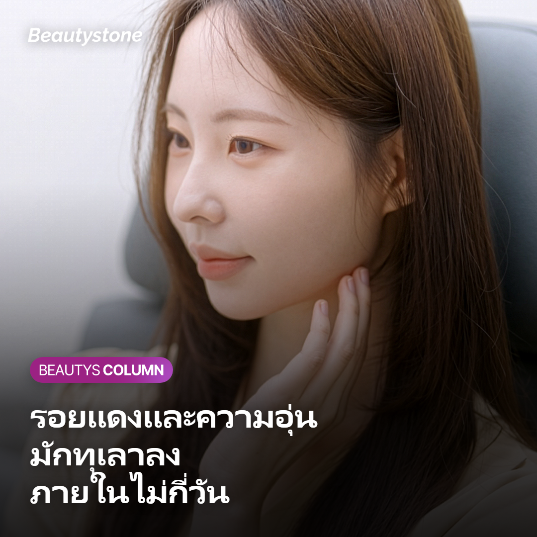 ภาพแสดงการทุเลาลงของรอยแดงและความอุ่นหลังทำ InMode FX