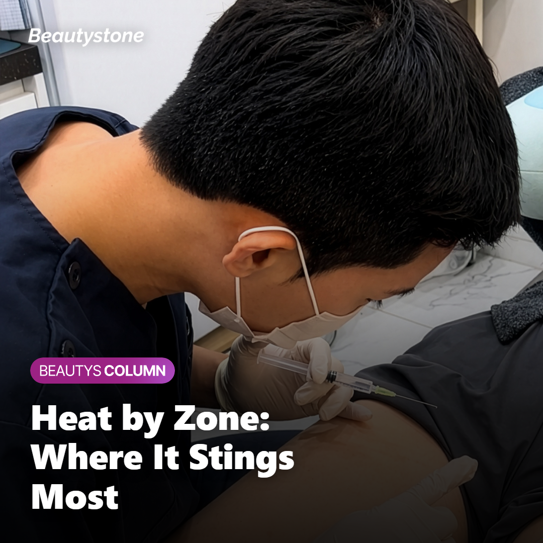 Zone-by-zone breakdown of InMode FX heat sensation during treatment