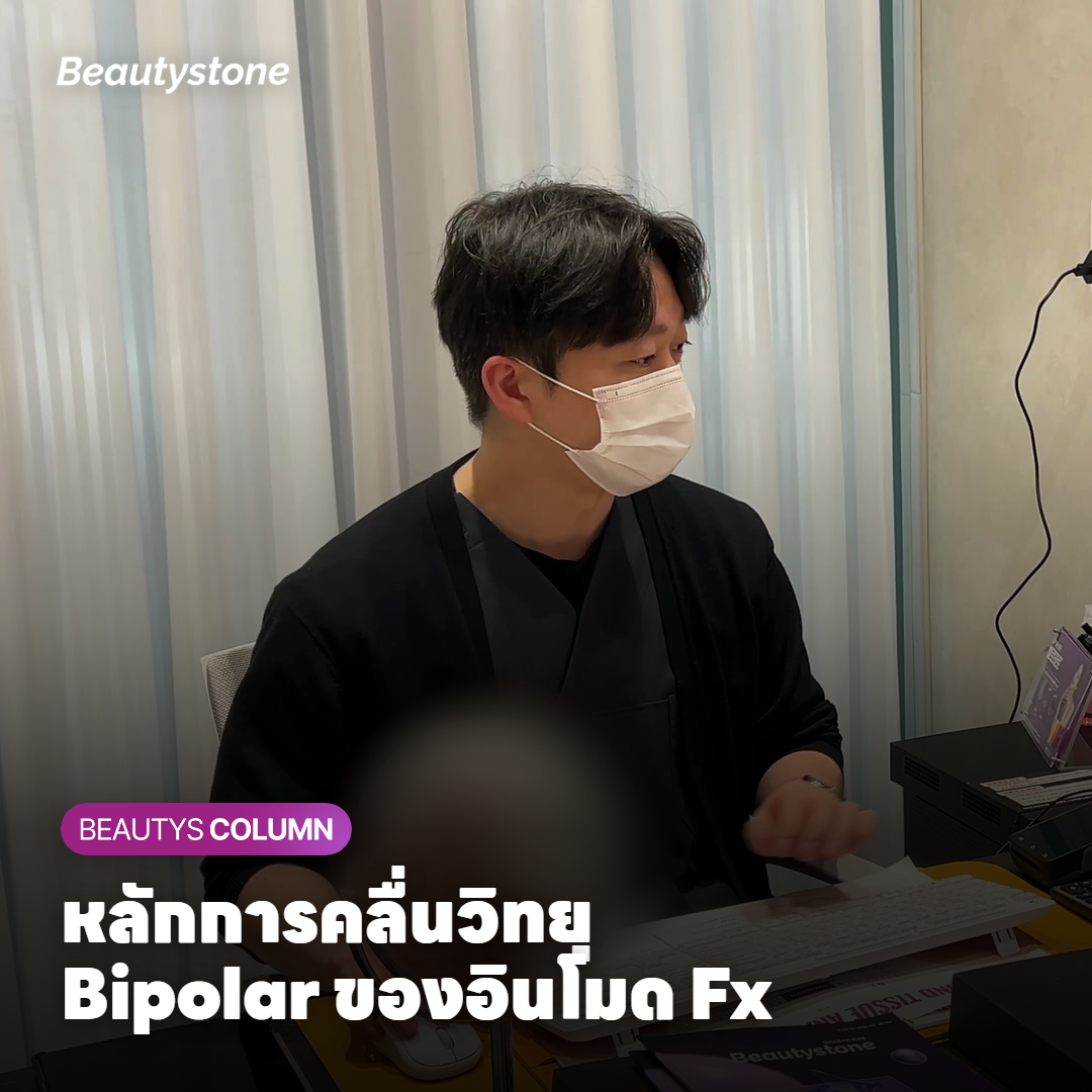 หลักการคลื่นวิทยุ Bipolar ของอินโมด Fx