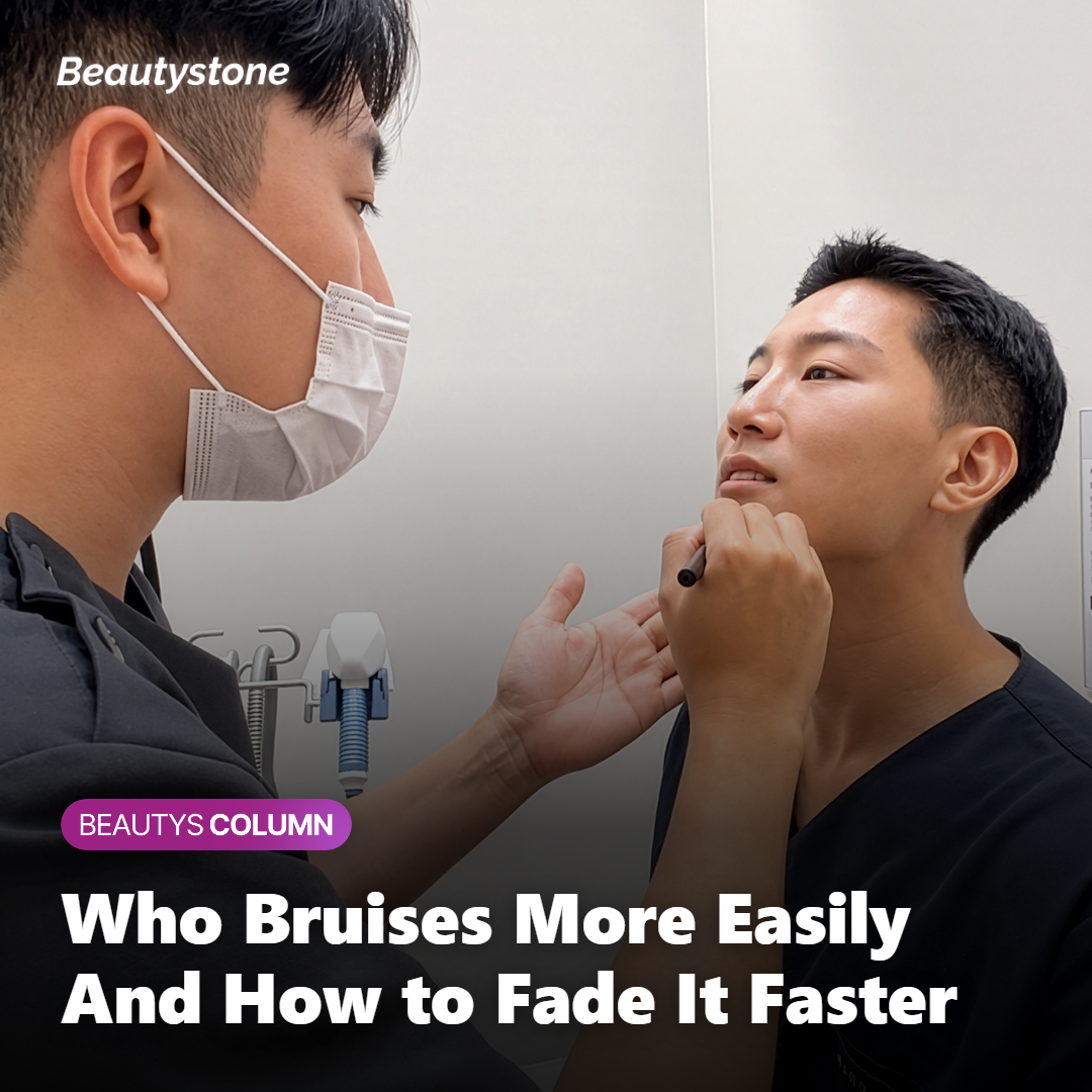 Close-up of the jawline and under-eye area where bruising is more likely after radiofrequency treatment