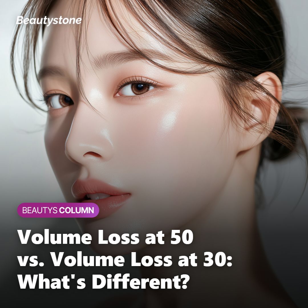 How midface volume loss differs between the 30s and the 50s