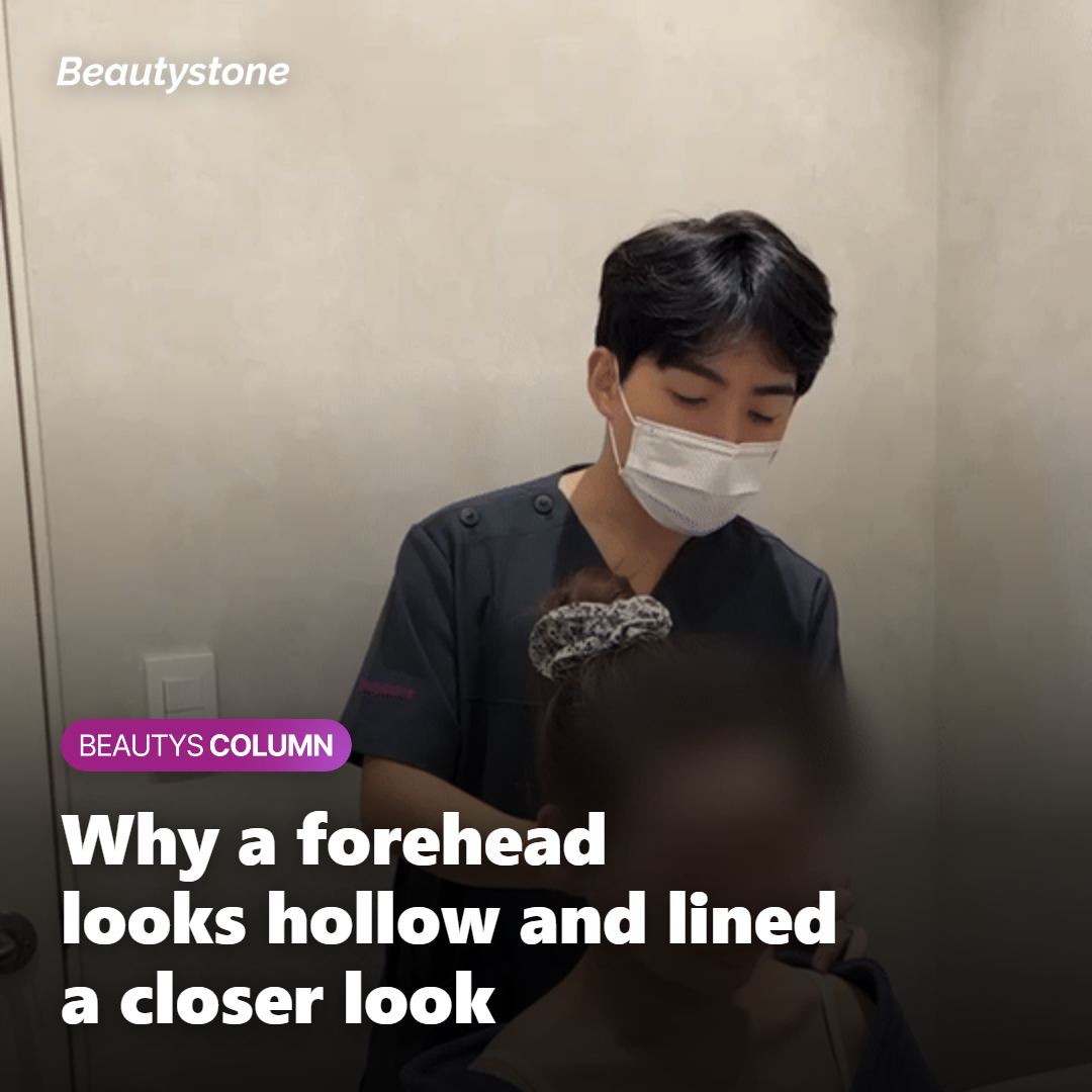 Illustration showing why a forehead looks hollow and gains fine lines