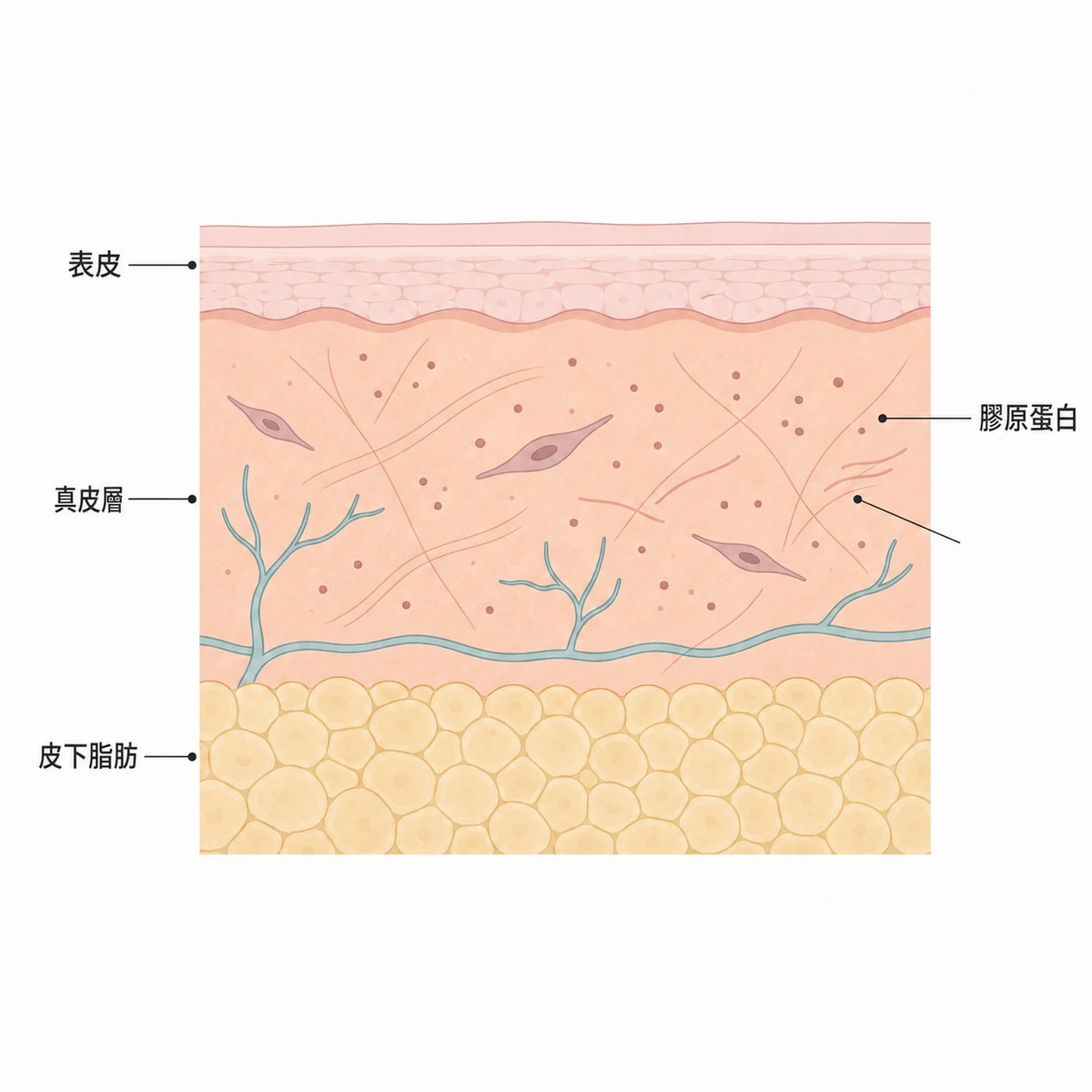 蘋果肌真皮層中新膠原蛋白逐漸填充的截面示意圖
