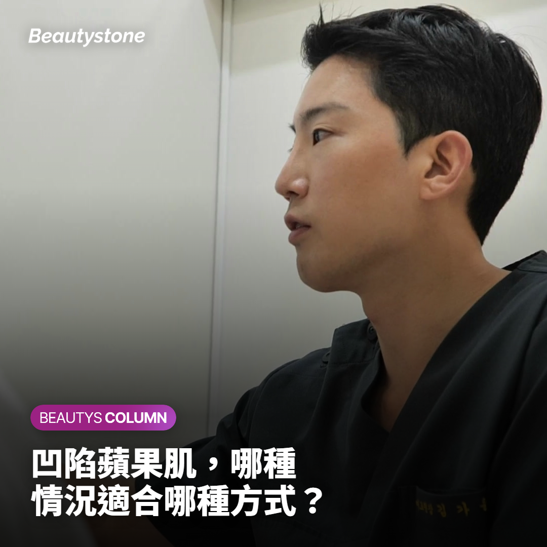 凹陷蘋果肌，哪種情況適合哪種方式？