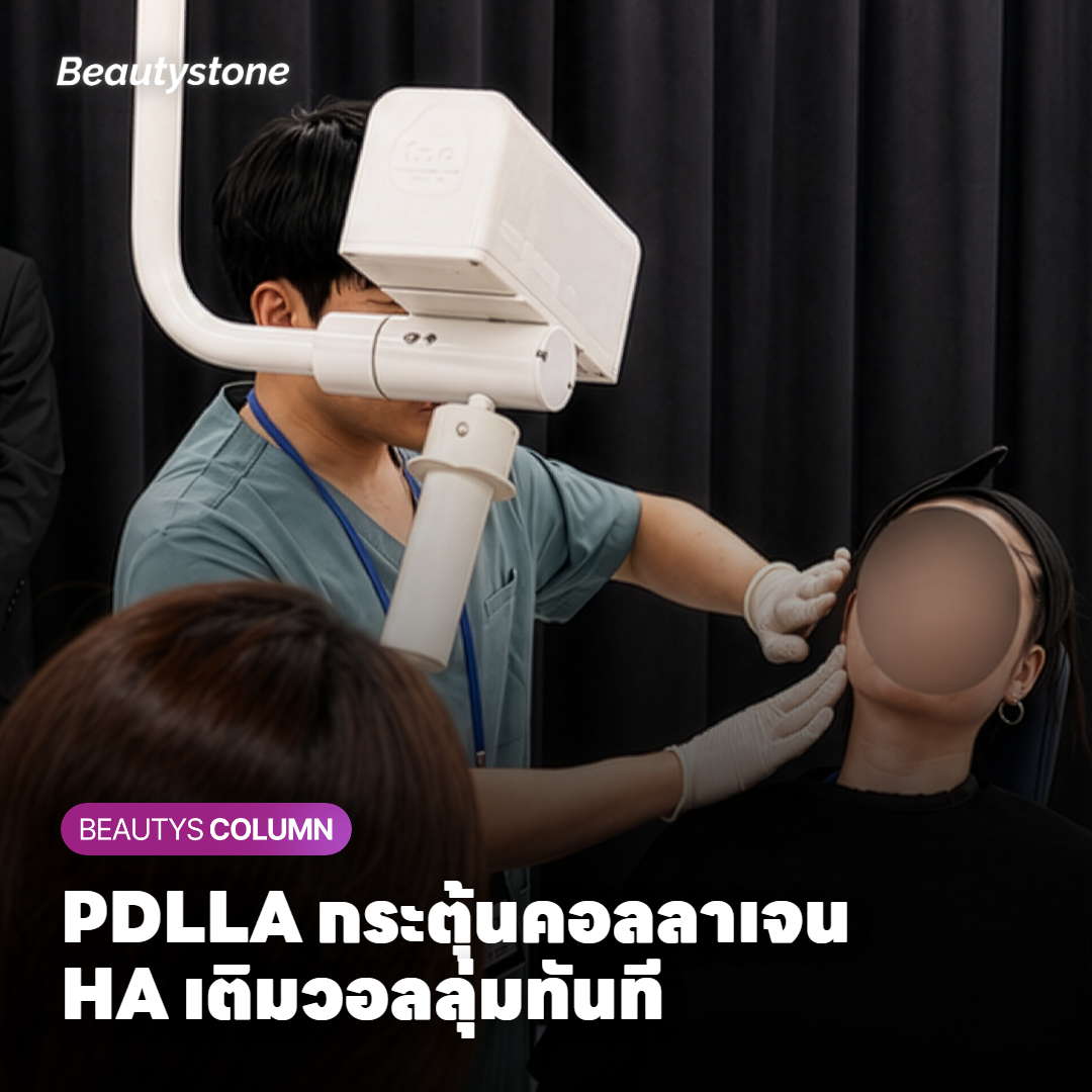 กลไก PDLLA กระตุ้นคอลลาเจนในชั้นผิวหนัง