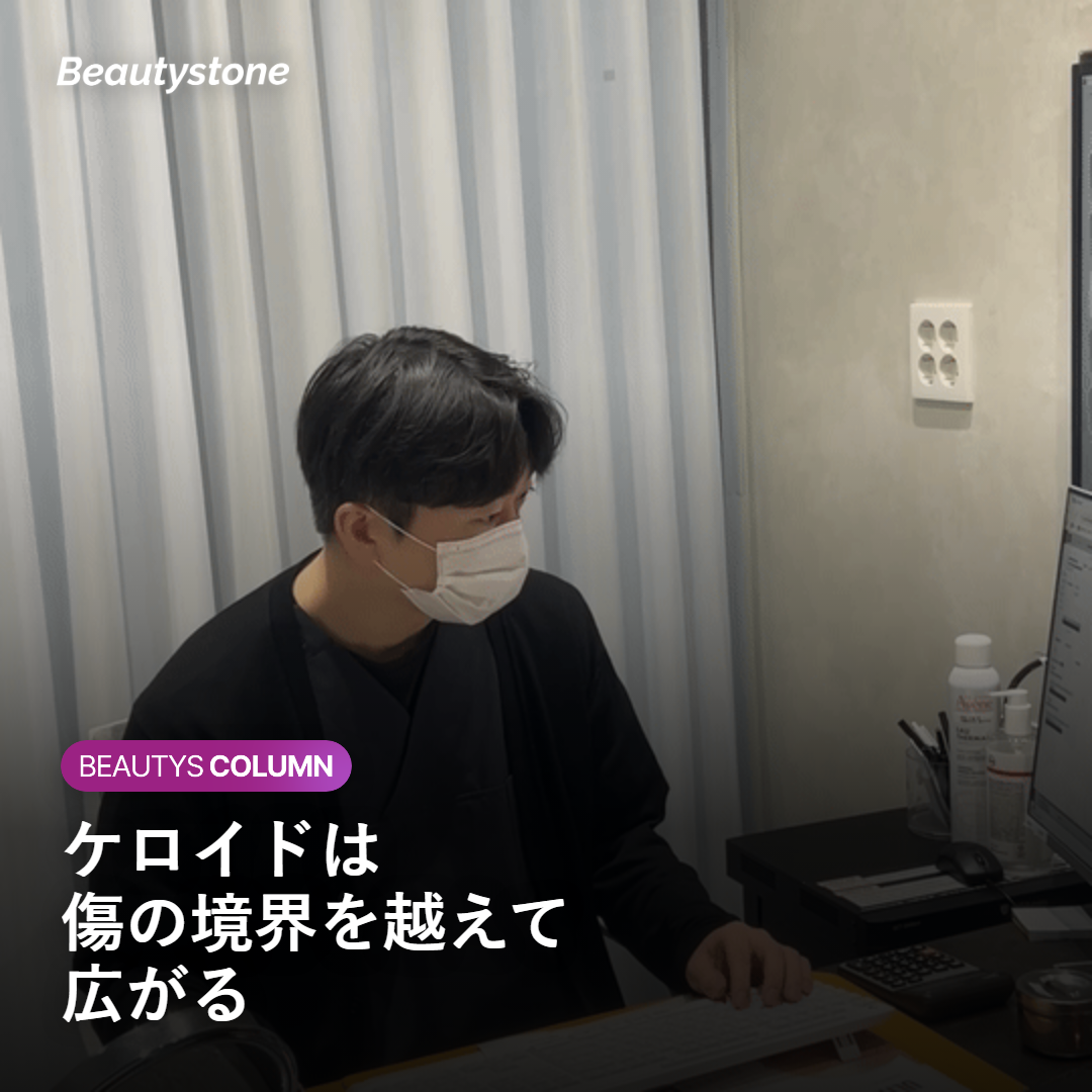 ケロイドが傷の境界を越えて広がることを示す図