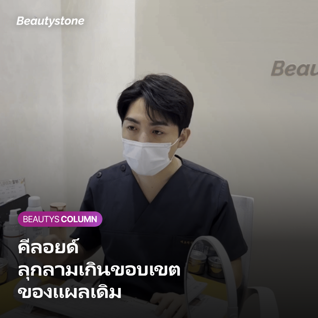 ภาพแสดงว่าคีลอยด์ลุกลามเกินขอบเขตของแผลเดิม