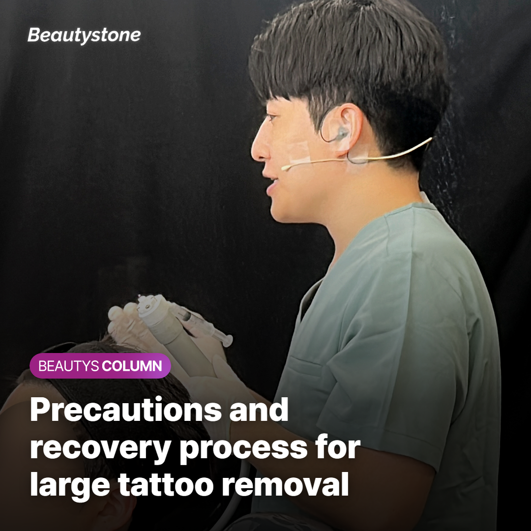 Precautions and recovery process for large tattoo removal