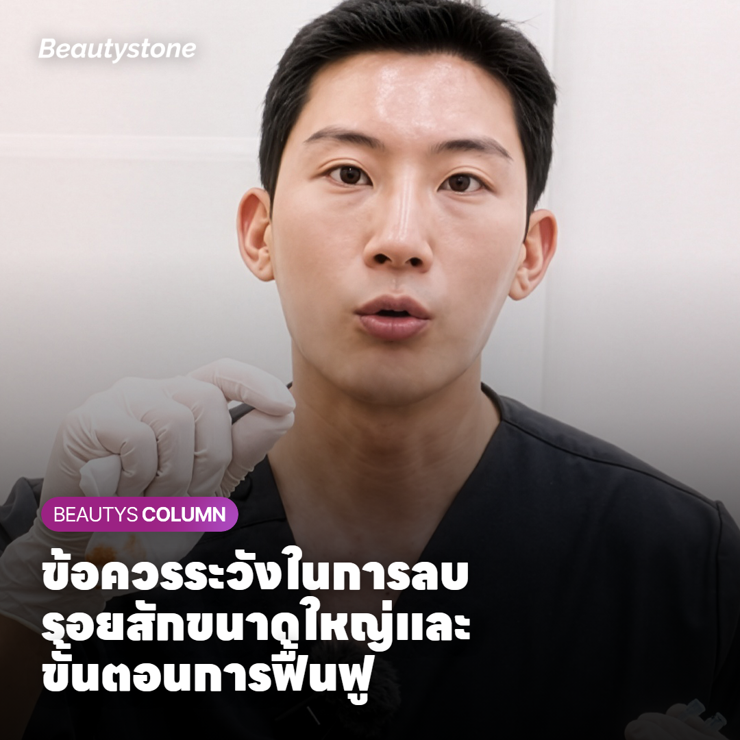 ข้อควรระวังในการลบรอยสักขนาดใหญ่และขั้นตอนการฟื้นฟู