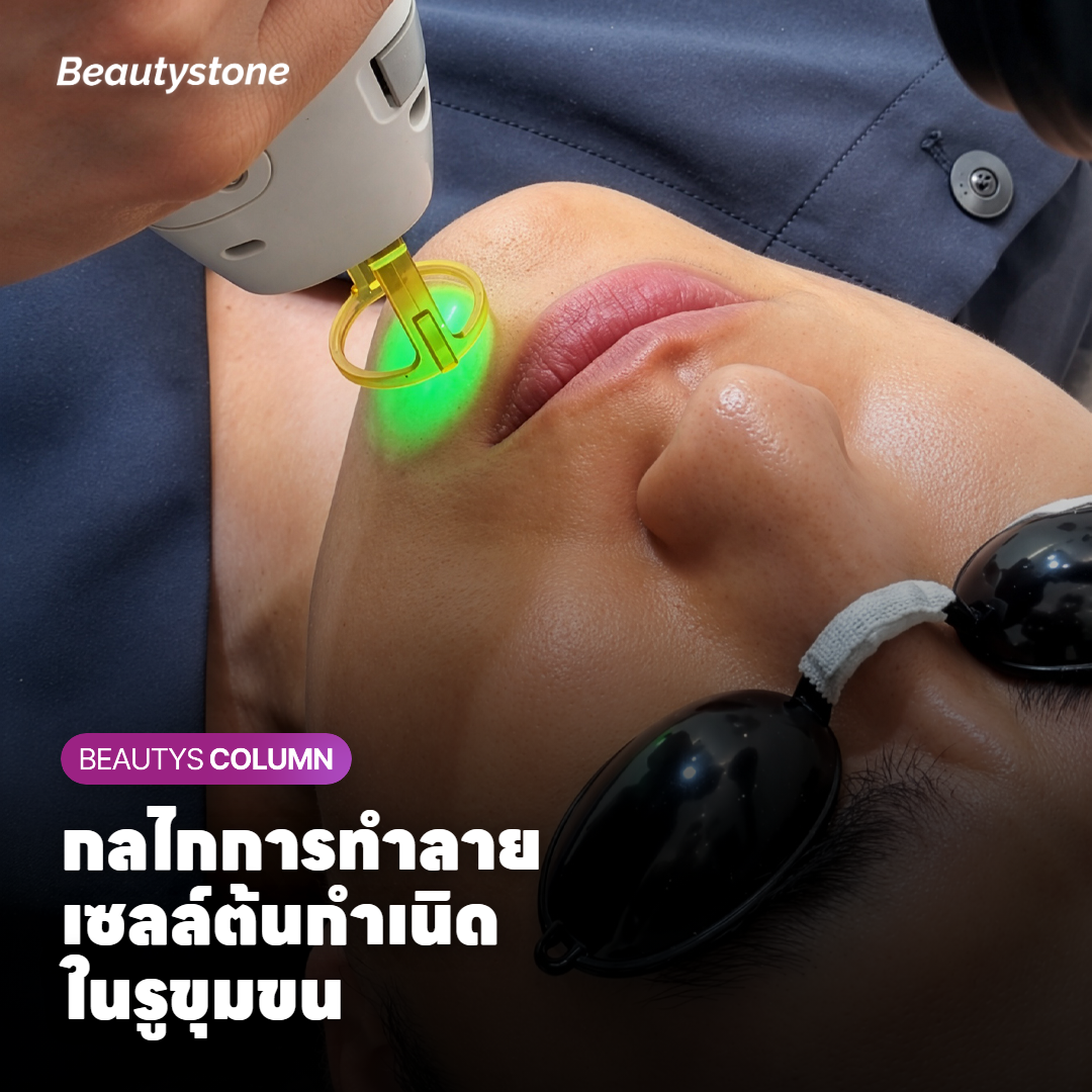กลไกการทำลายเซลล์ต้นกำเนิดในรูขุมขน