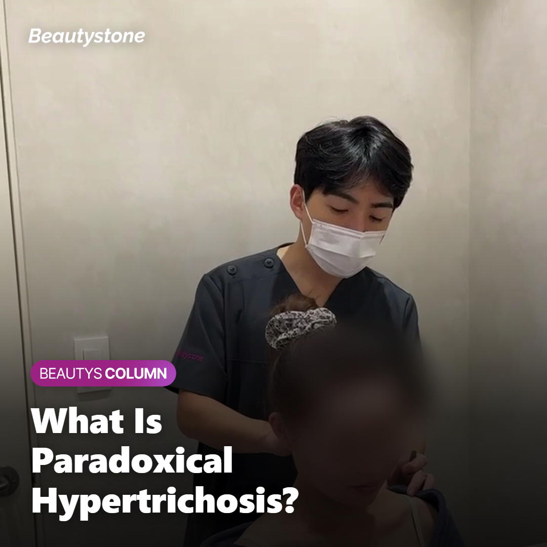 What Is Paradoxical Hypertrichosis?