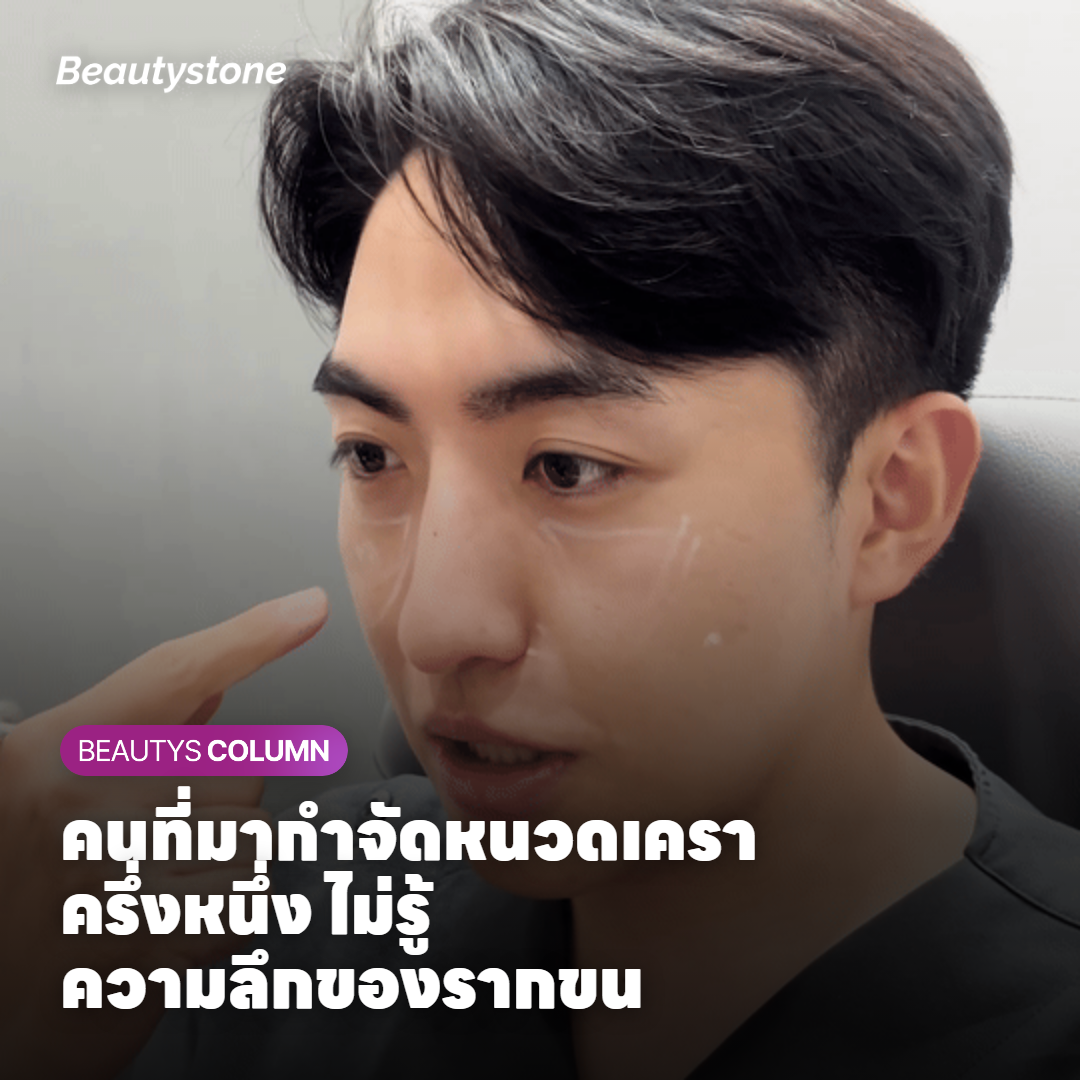 คู่มือกำจัดหนวดเคราด้วยเลเซอร์สำหรับผู้ชาย