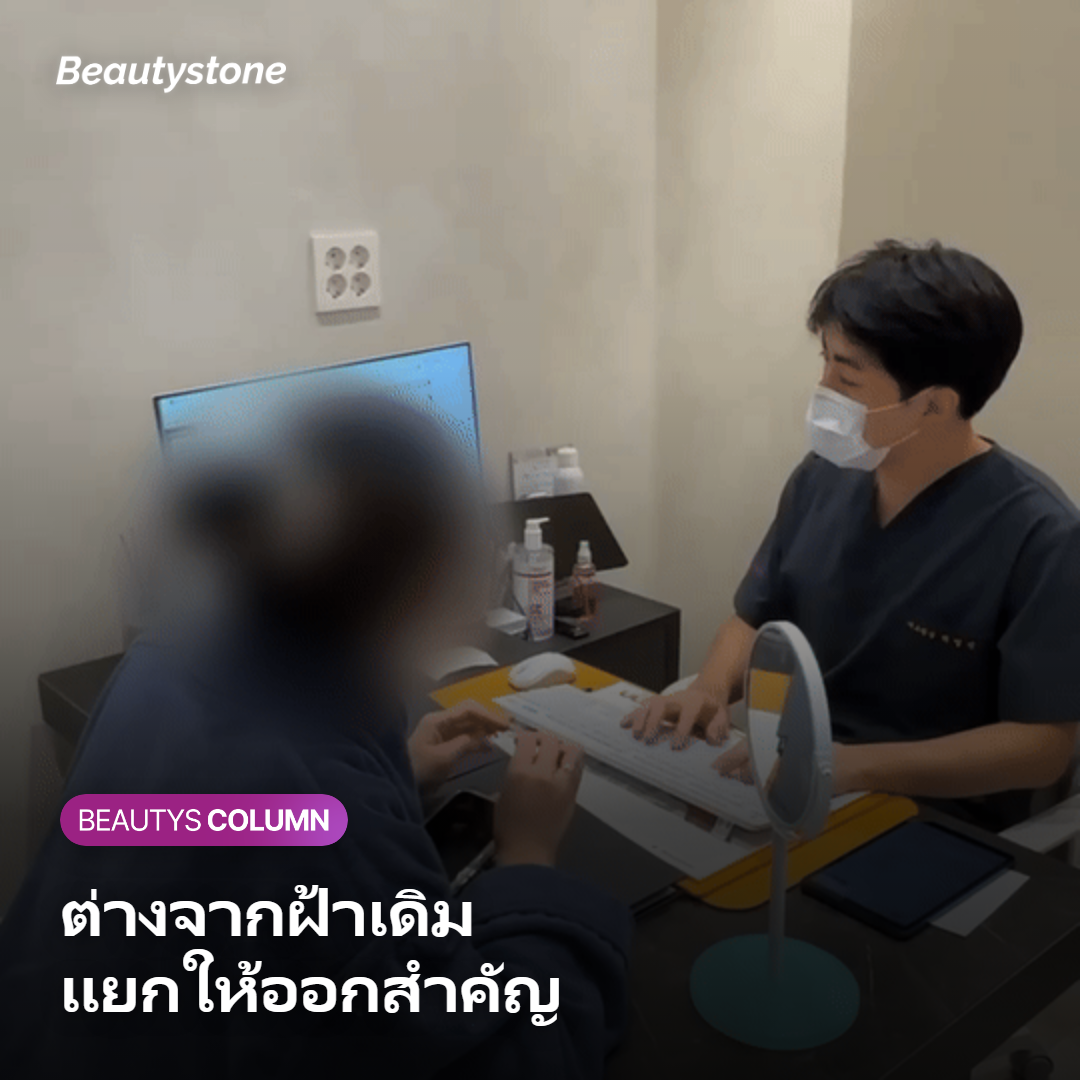 การ์ดเปรียบเทียบรอยดำหลังทำเลเซอร์กับฝ้ากระเดิม
