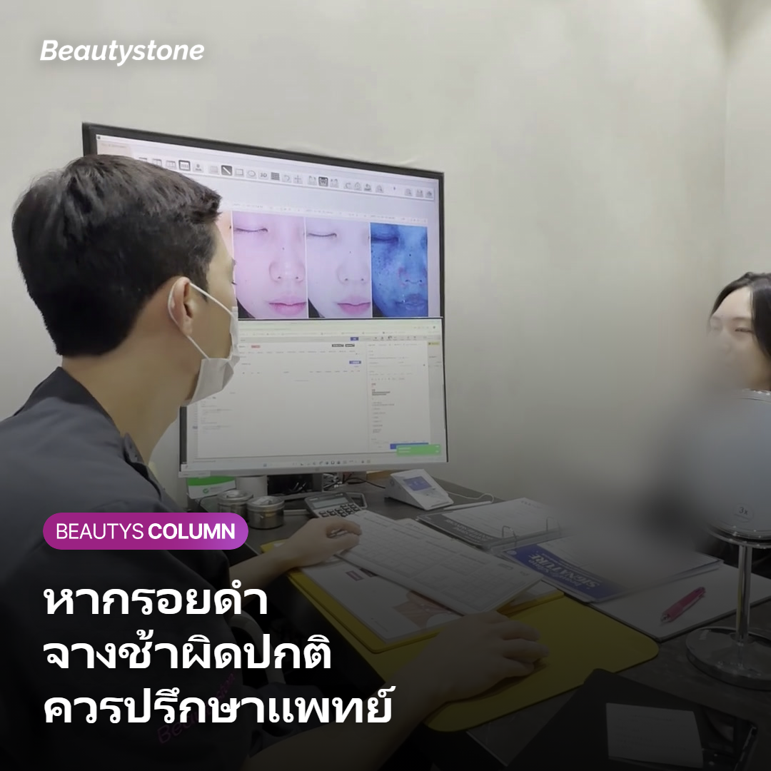 ภาพแสดงข้อควรระวังและการปรึกษาแพทย์เมื่อเกิดรอยดำ