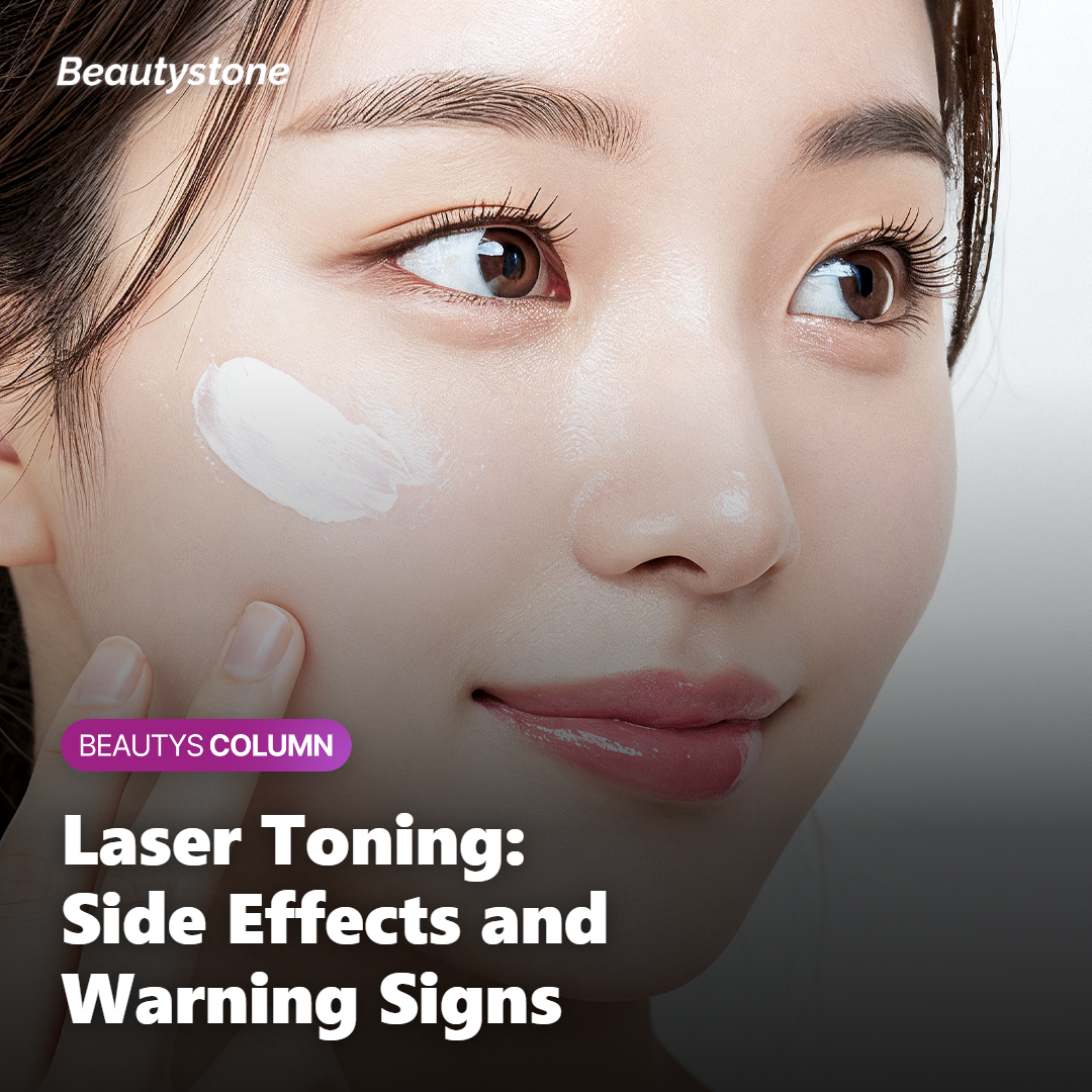 Melanocytes producing extra melanin causing temporary darkening after laser toning
