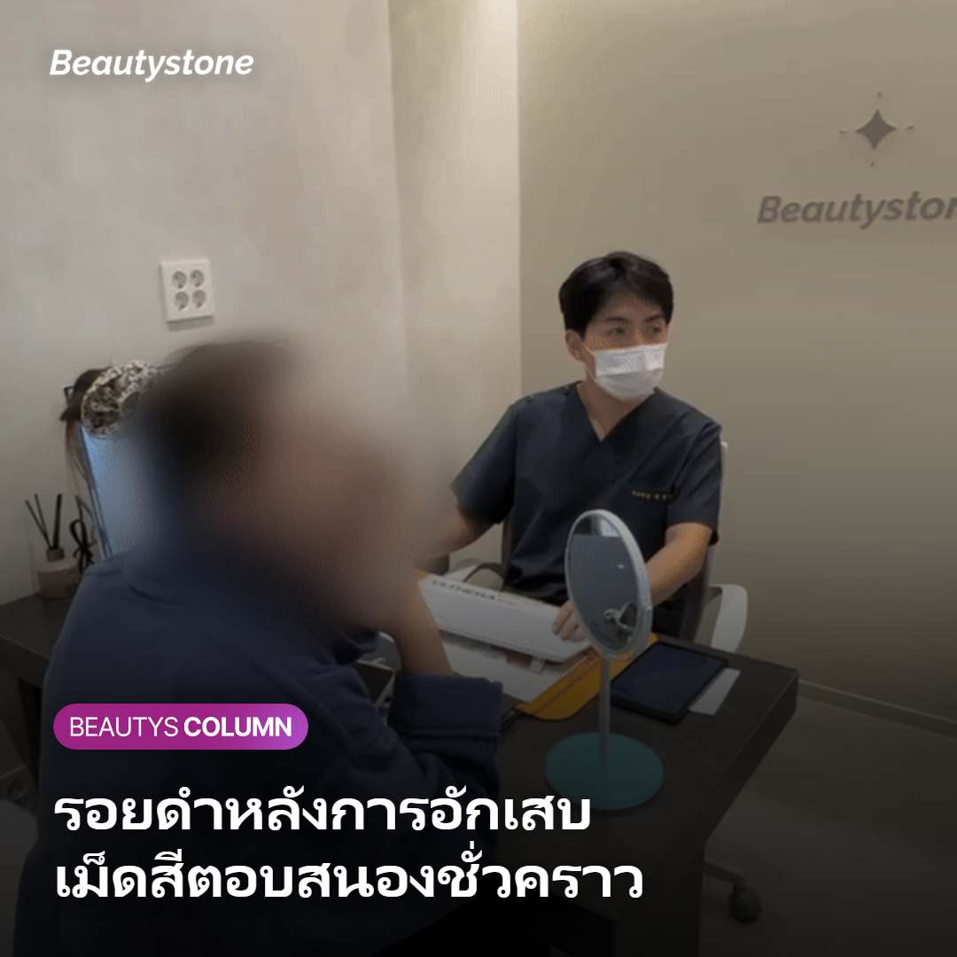 ภาวะรอยดำหลังการอักเสบที่ทำให้ผิวดูเข้มขึ้นชั่วคราวหลังทำเลเซอร์