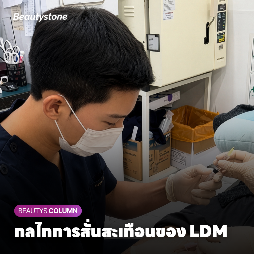 กลไกการสั่นสะเทือนของ LDM