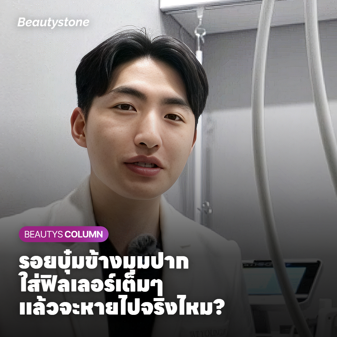 รอยบุ๋มข้างมุมปาก ใส่ฟิลเลอร์เต็มๆ แล้วจะหายไปจริงไหม?