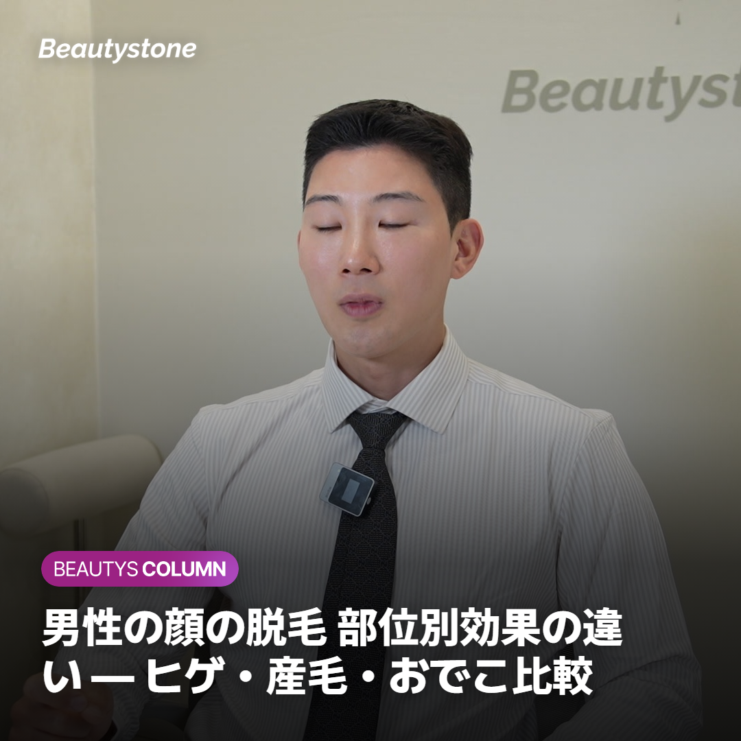 男性の顔の脱毛 部位別効果の違い — ヒゲ・産毛・おでこ比較