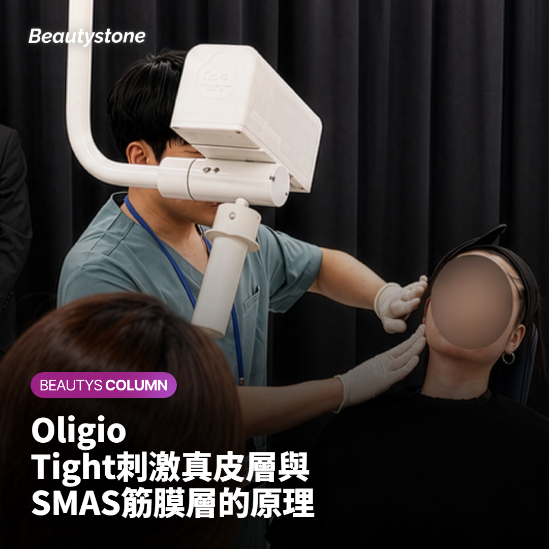 Oligio Tight刺激真皮層與SMAS筋膜層的原理