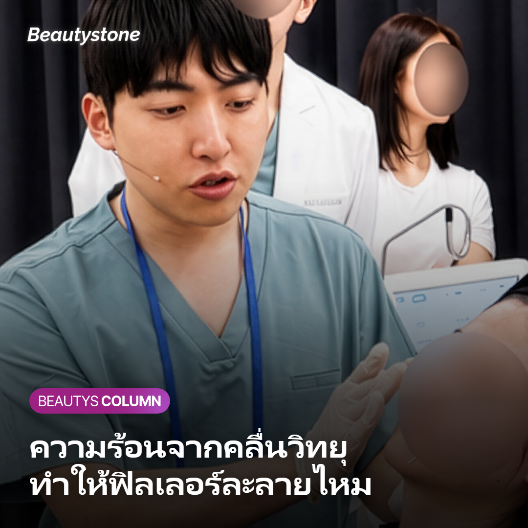หัวจ่ายพลังงานคลื่นวิทยุขณะทำหัตถการยกกระชับบนใบหน้า