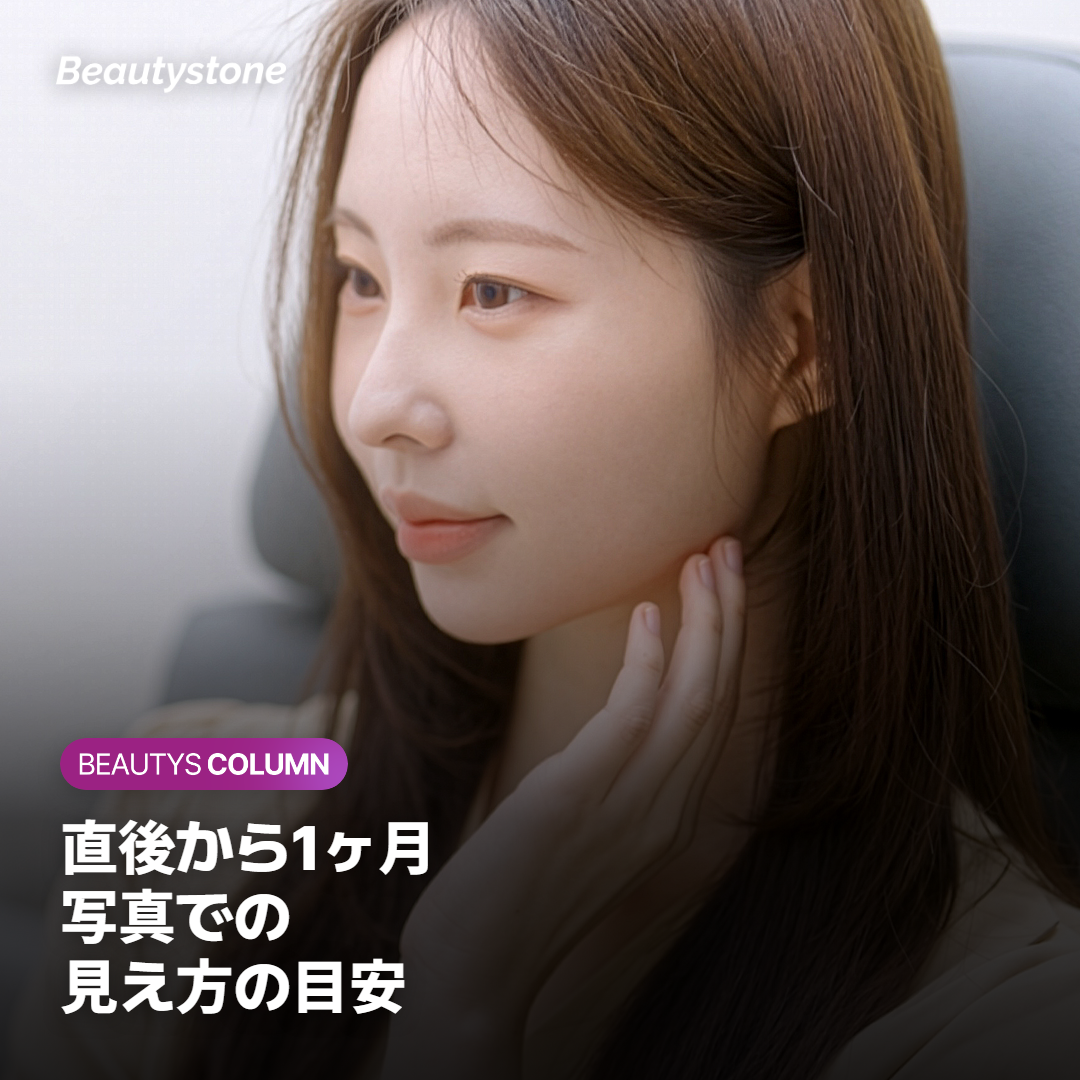写真での見え方はどう変わる？直後から1ヶ月までの経過
