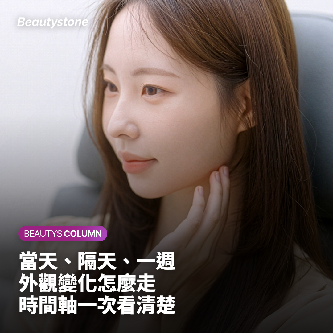 術後當天到一個月外觀變化的時間軸整理圖