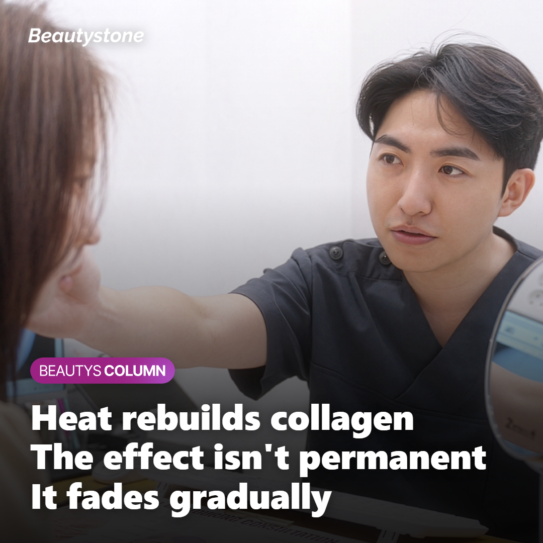 Collagen remodeling that keeps firmness up for a while but is not permanent