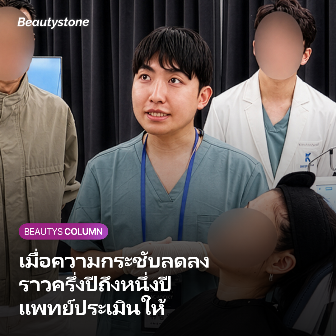 ภาพแสดงจังหวะพิจารณาทำซ้ำเมื่อความกระชับเริ่มลดลง