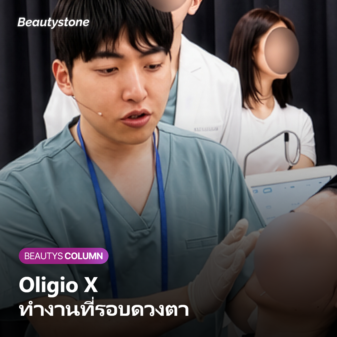 ภาพแสดงการทำงานของ Oligio X แบบ RF โมโนโพลาร์ที่รอบดวงตา