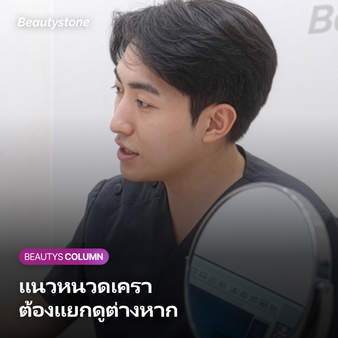 แนวหนวดเคราที่มีรูขุมขนหนาแน่นและต้องดูแลแยกจากบริเวณอื่น