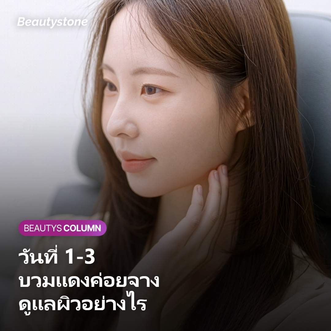 Timeline การฟื้นตัวหลังทำ Oligio X แบบวันต่อวัน
