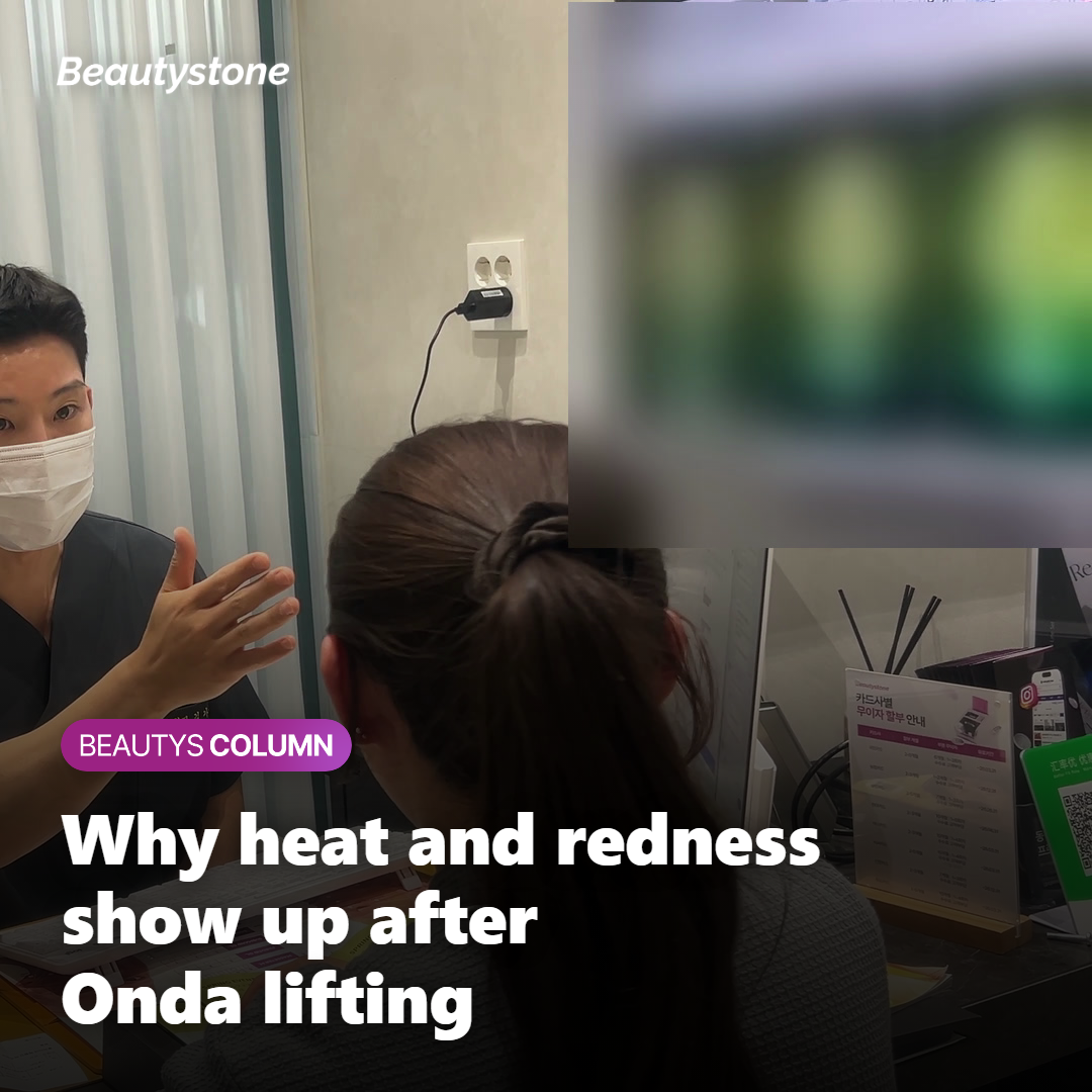 Illustration showing why heat and redness show up after Onda lifting
