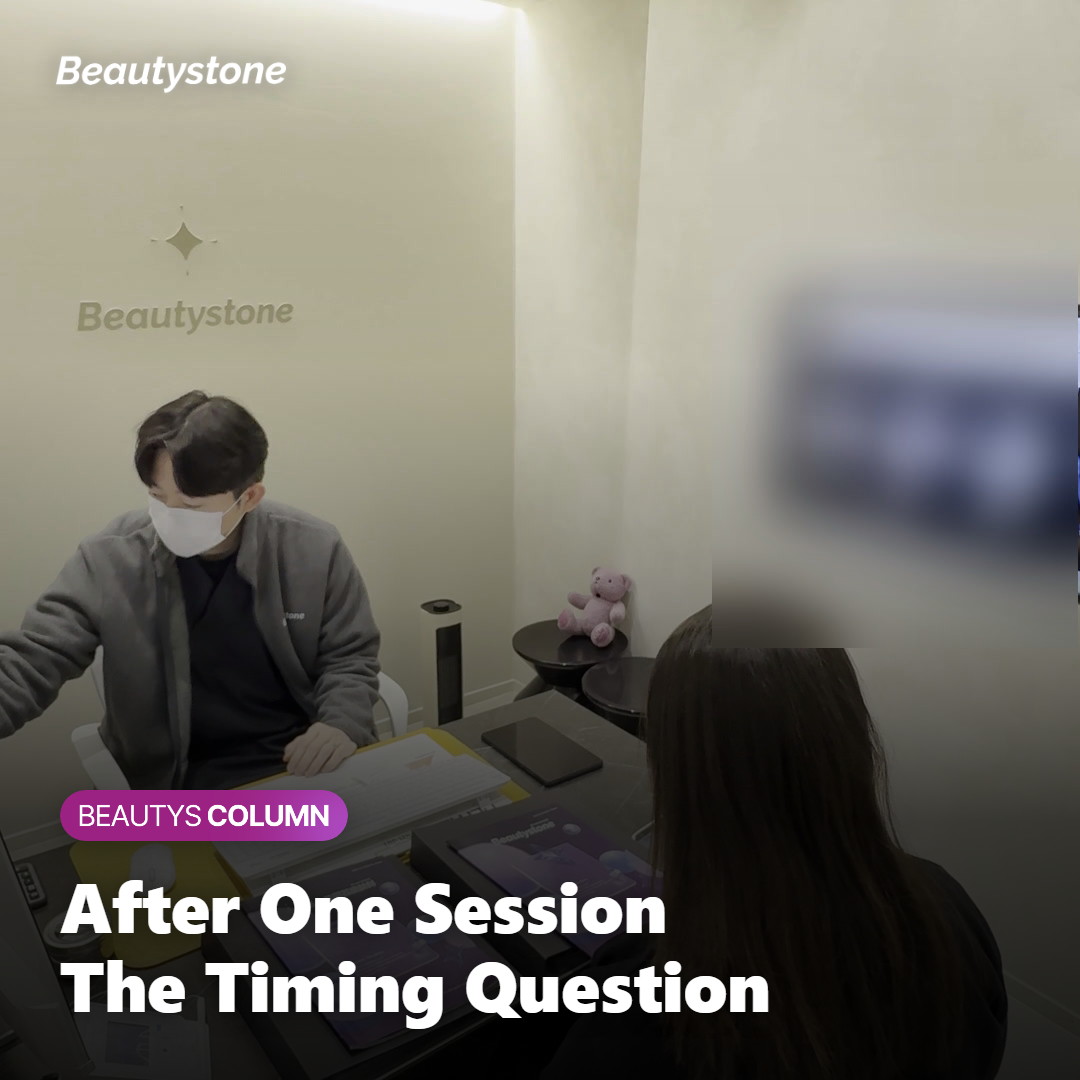 Illustration of the timing question after a first Onda session