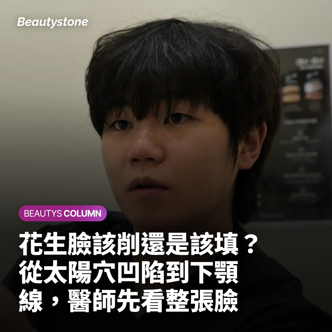 花生臉該削還是該填？從太陽穴凹陷到下顎線，醫師先看整張臉
