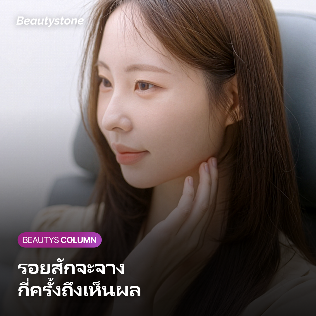 ภาพการ์ดแสดงรอยสักที่ค่อย ๆ จางลงเมื่อทำหลายครั้ง